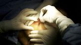 Las ‘maestrías en cirugía estética’ son un riesgo para la salud, alerta la Cofepris