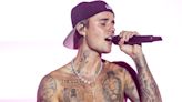 Justin Bieber reassures fans on Ramsay Hunt syndrome: What are the signs and symptoms?