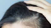 Sulfate-Based Shampoos And Hair Washing Mistakes May Cause Thinning Hair