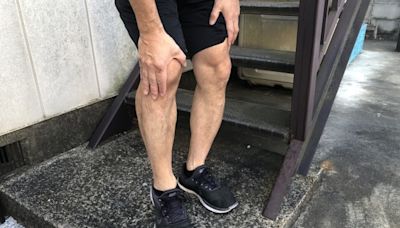 50歲壯男膝蓋有「喀喀」怪聲 醫揭半月板損傷4大症狀
