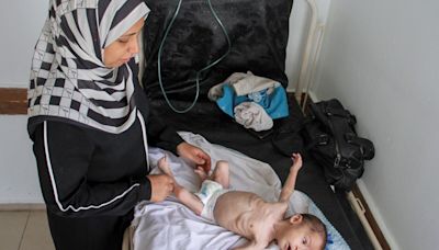 Children Starve As Millions Of Gaza Inhabitants Face Famine Threat