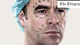 The midlife men hooked on cosmetic procedures – but afraid to admit it