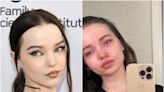 Dove Cameron shares crying selfies as she details struggle with ‘depression and dysphoria’