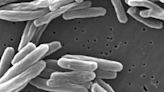 US tuberculosis cases were at the highest level in a decade in 2023