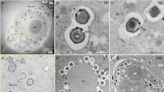 Giant virus discovered in wastewater treatment plant infects deadly parasite