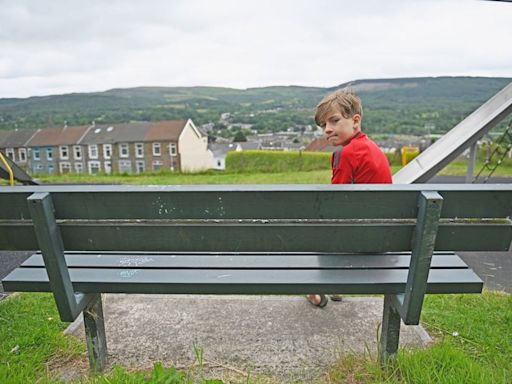 Boy playing football in park suffers horrendous injury from broken bottle