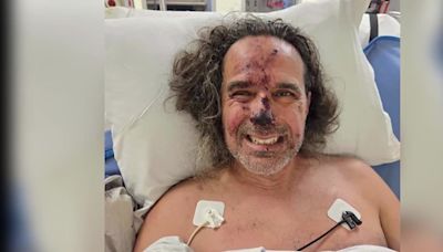 ‘I just don’t give up’: Man on the mend after surviving 700 feet fall in Oregon