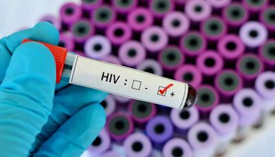 47 Students Die Due To HIV In Tripura, 828 Test Positive; Symptoms And Preventive Measures Of The Infection