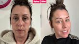 I tried to fix my dark under-eye bags with TikTok’s 23p viral hack