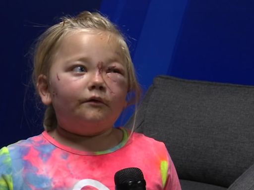 GRAPHIC: Boy saves 6-year-old sister during dog attack: ‘I didn’t want her to die’