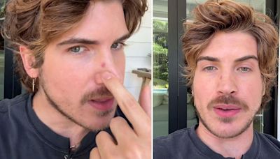 Classic YouTuber Joey Graceffa, 33, reveals skin cancer diagnosis