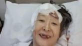 罹腦癌不化療門牙掉光 67歲尹石花近況曝光