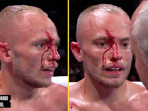 Sunny Edwards suffers horror cut that commentator calls 'zipper on his forehead'