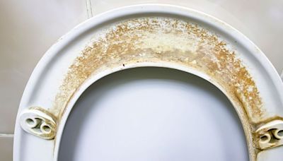 Toilet seat stains don’t lift with bleach but do in 10 seconds with 20p item