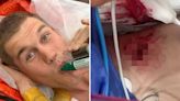 Olympics star shows off gruesome gash in his side after horror cycling crash