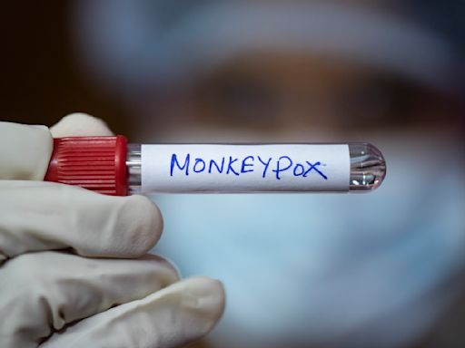 Une souche ultra-mortelle de la variole du singe traverse les frontières, l’OMS en alerte maximale