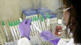 Un mexicano, la primera víctima mortal de gripe aviar en el mundo: un doctor explica cómo evitar el contagio
