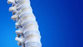 Una espalda libre y sana: 5 acciones para derrotar al dolor lumbar