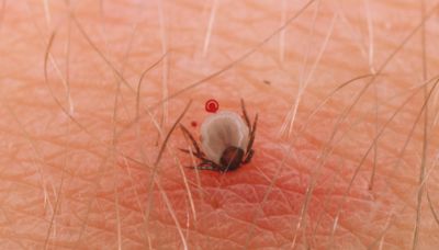 Lyme disease increase risk due to climate change