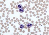 Neutrophil