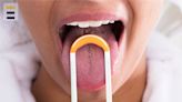 What your tongue can tell you about your health
