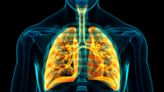 Zinc intake linked to lower asthma risk for overweight, obese kids