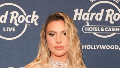 Influencer Lele Pons opens up about ‘really bad’ pit bull bite she suffered while rescuing her dog