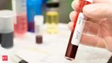 HIV breakthrough: Drug trial shows injection twice a year is 100% effective against infection - The Economic Times