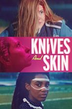 Knives and Skin