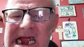 'I pulled teeth out with pliers' - Man forced to take drastic measures