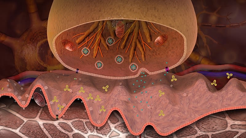 Myasthenia Gravis Treatment: 5 Things to Know