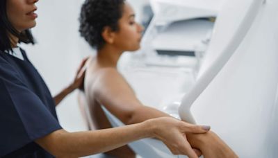 Women should start getting mammograms at 40, new guidance says