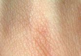 Human skin