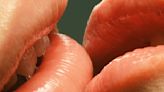 ¿Pueden los besos transmitir caries? Esto es lo que dice la ciencia