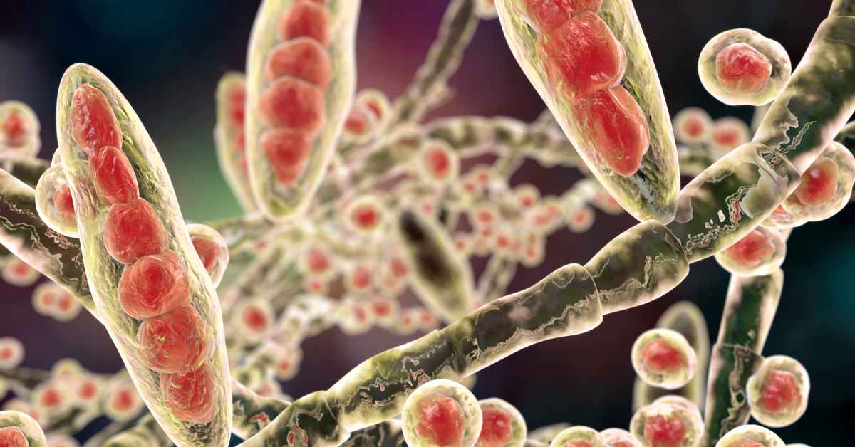 First U.S. Case of Rare Fungal STI Reported