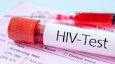 Experimental cancer drug may help clear HIV from brain cells