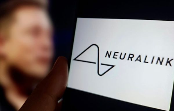 Elon Musk’s Neuralink brain chip trial has already had some hiccups