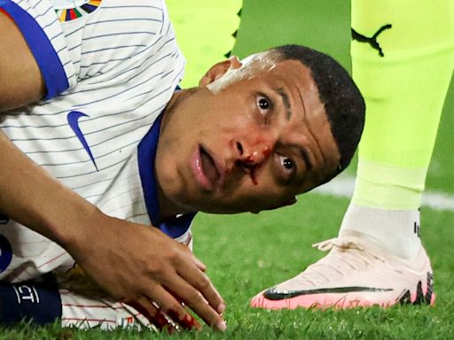 Kylian Mbappé blessé au nez : cette solution sur mesure pour son retour dans l'Euro 2024