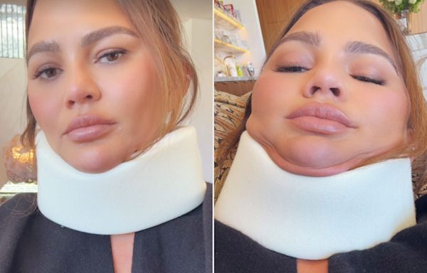 Chrissy Teigen Models a Neck Brace and Jokes She Skipped the 2024 Met Gala Because a Headstand 'Didn’t Go Well'