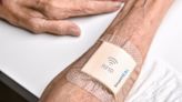 SmartHEAL: así es el sensor para apósitos que indica el nivel de curación de una herida