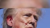 Trump was indeed struck by bullet during assassination attempt, says FBI