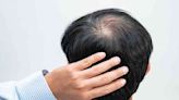 RAPUNZILLA: What actually helps with hair loss, especially in men