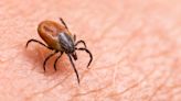 Genetic study of virulent Lyme disease bacteria offers clues to long-lasting symptoms