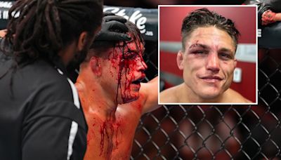 Watch UFC star bravely carry on fighting despite huge 'gross' cut to his eye