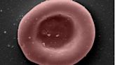 ‘Lab-grown red blood cells transfused in to person in a world first’