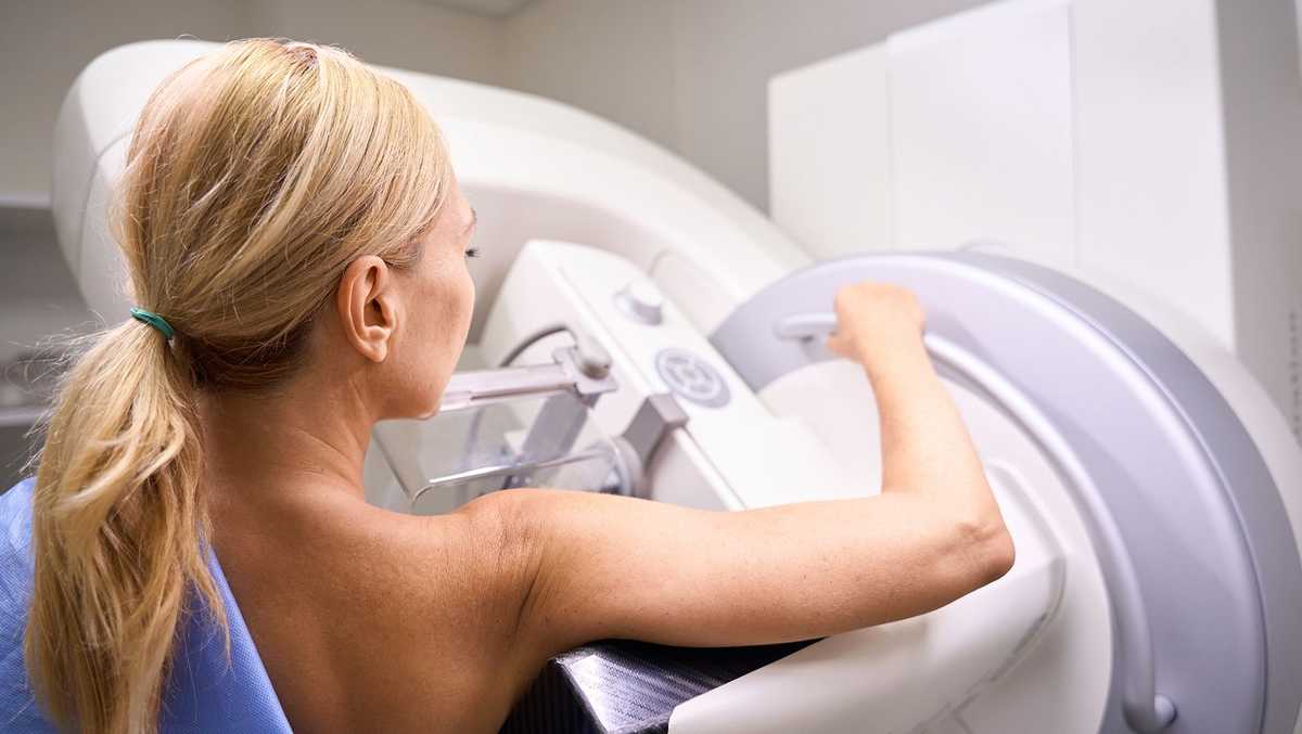 Mammograms are now recommended starting at age 40. Should you get one?