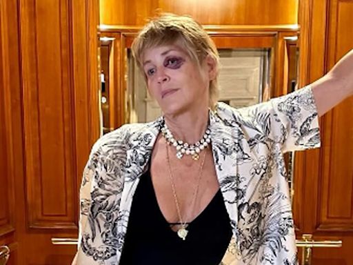 Sharon Stone llevó tranquilidad a sus seguidores y reveló el misterio de su ojo morado: “Me desorienté”