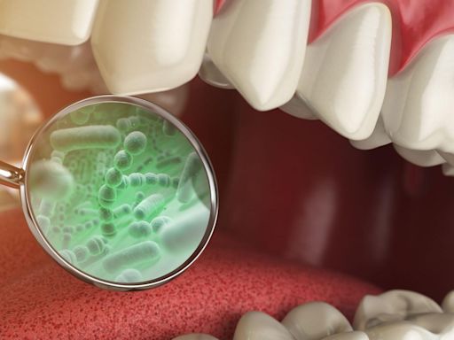 Cáncer de colon y otras 3 enfermedades vinculadas con las bacterias que se encuentran en tu boca