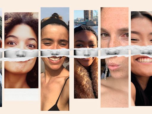 How nose jobs went viral