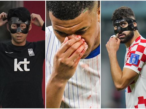 La lesión de Kylian Mbappé: cómo es la máscara protectora que utilizará y cómo afecta a la visión